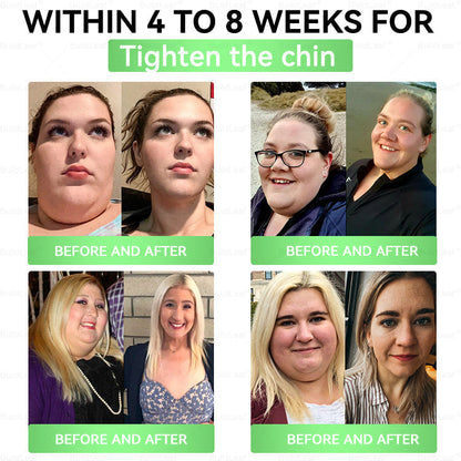 🌟𝘽𝙪𝙞𝙡𝙙𝙇𝙚𝙖𝙛® 𝗚𝗟𝗣-𝟭 𝟐𝟎-𝐢𝐧-𝟏 𝐒𝐥𝐢𝐦 & 𝐇𝐞𝐚𝐥𝐭𝐡 𝐎𝐫𝐚𝐥 𝐒𝐨𝐥𝐮𝐭𝐢𝐨𝐧 (𝑶𝒏𝒄𝒆 𝒂 𝒅𝒂𝒚, 𝒓𝒆𝒔𝒖𝒍𝒕𝒔 𝒊𝒏 7 𝒅𝒂𝒚𝒔), 𝑾𝒊𝒕𝒉 100 𝑩𝒊𝒍𝒍𝒊𝒐𝒏 𝑪𝑭𝑼 𝑨𝒄𝒕𝒊𝒗𝒆 𝑷𝒓𝒐𝒃𝒊𝒐𝒕𝒊𝒄𝒔 ✅ 𝑺𝒖𝒑𝒑𝒐𝒓𝒕𝒔 𝒘𝒆𝒊𝒈𝒉𝒕 𝒎𝒂𝒏𝒂𝒈𝒆𝒎𝒆𝒏𝒕, 𝒉𝒆𝒂𝒓𝒕 𝒉𝒆𝒂𝒍𝒕𝒉, 𝒅𝒊𝒂𝒃𝒆𝒕𝒆𝒔, 𝒈𝒖𝒕 & 𝒘𝒐𝒎𝒆𝒏’𝒔 𝒉𝒆𝒂𝒍𝒕𝒉, 𝒘𝒉𝒊𝒍𝒆 𝒇𝒊𝒓𝒎𝒊𝒏𝒈 𝒔𝒌𝒊𝒏 & 𝒃𝒐𝒐𝒔𝒕𝒊𝒏𝒈 𝒆𝒏𝒆𝒓𝒈𝒚