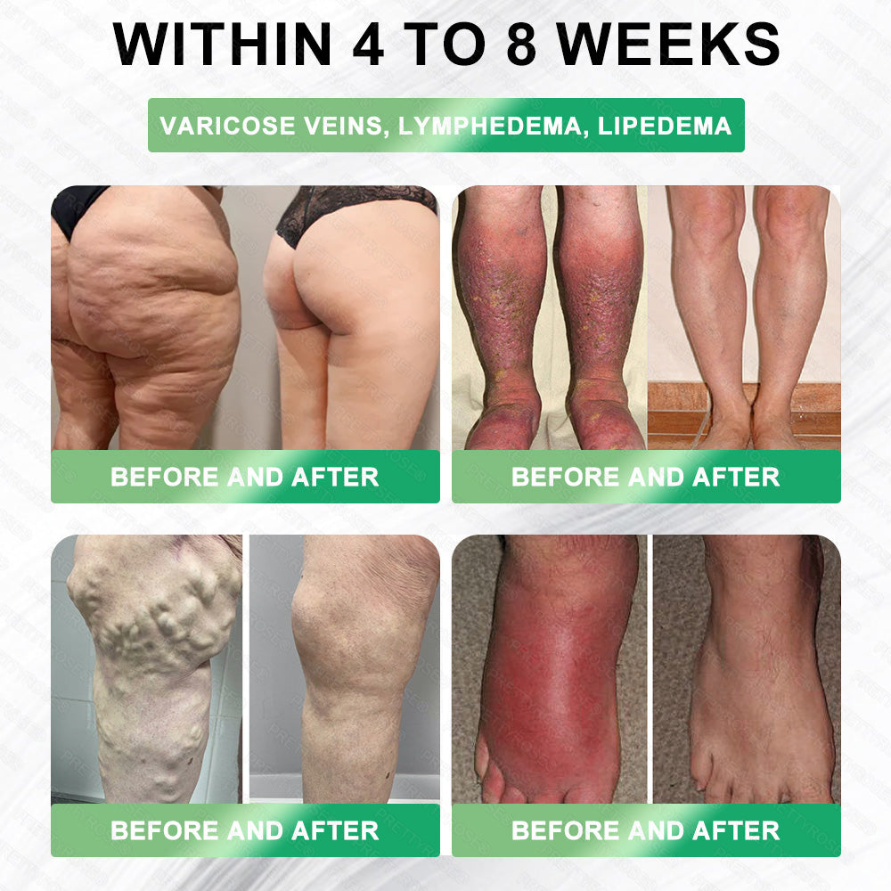 𝑷𝒓𝒆𝒕𝒕𝒚𝒓𝒐𝒔𝒆® 𝐺𝐿𝑃-1 6-𝑖𝑛-1 𝑴𝒆𝒕𝒂𝒃𝒐𝒍𝒊𝒄 𝑹𝒆𝒗𝒊𝒕𝒂𝒍𝒊𝒛𝒊𝒏𝒈 𝐎𝐫𝐚𝐥 𝐒𝐨𝐥𝐮𝐭𝐢𝐨𝐧 | 𝗦𝘂𝗽𝗽𝗼𝗿𝘁𝘀 𝗔𝗽𝗽𝗲𝘁𝗶𝘁𝗲 𝗖𝗼𝗻𝘁𝗿𝗼𝗹 · 𝗕𝗼𝗼𝘀𝘁𝘀 𝗠𝗲𝘁𝗮𝗯𝗼𝗹𝗶𝘀𝗺 · 𝗥𝗲𝗱𝘂𝗰𝗲𝘀 𝗕𝗹𝗼𝗮𝘁𝗶𝗻𝗴 & 𝗪𝗮𝘁𝗲𝗿 𝗥𝗲𝘁𝗲𝗻𝘁𝗶𝗼𝗻