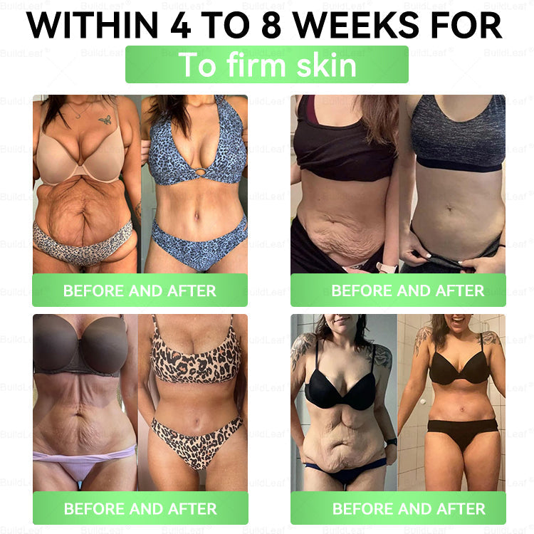 🌟𝘽𝙪𝙞𝙡𝙙𝙇𝙚𝙖𝙛® 𝗚𝗟𝗣-𝟭 𝟐𝟎-𝐢𝐧-𝟏 𝐒𝐥𝐢𝐦 & 𝐇𝐞𝐚𝐥𝐭𝐡 𝐎𝐫𝐚𝐥 𝐒𝐨𝐥𝐮𝐭𝐢𝐨𝐧 (𝑶𝒏𝒄𝒆 𝒂 𝒅𝒂𝒚, 𝒓𝒆𝒔𝒖𝒍𝒕𝒔 𝒊𝒏 7 𝒅𝒂𝒚𝒔), 𝑾𝒊𝒕𝒉 100 𝑩𝒊𝒍𝒍𝒊𝒐𝒏 𝑪𝑭𝑼 𝑨𝒄𝒕𝒊𝒗𝒆 𝑷𝒓𝒐𝒃𝒊𝒐𝒕𝒊𝒄𝒔 ✅ 𝑺𝒖𝒑𝒑𝒐𝒓𝒕𝒔 𝒘𝒆𝒊𝒈𝒉𝒕 𝒎𝒂𝒏𝒂𝒈𝒆𝒎𝒆𝒏𝒕, 𝒉𝒆𝒂𝒓𝒕 𝒉𝒆𝒂𝒍𝒕𝒉, 𝒅𝒊𝒂𝒃𝒆𝒕𝒆𝒔, 𝒈𝒖𝒕 & 𝒘𝒐𝒎𝒆𝒏’𝒔 𝒉𝒆𝒂𝒍𝒕𝒉, 𝒘𝒉𝒊𝒍𝒆 𝒇𝒊𝒓𝒎𝒊𝒏𝒈 𝒔𝒌𝒊𝒏 & 𝒃𝒐𝒐𝒔𝒕𝒊𝒏𝒈 𝒆𝒏𝒆𝒓𝒈𝒚